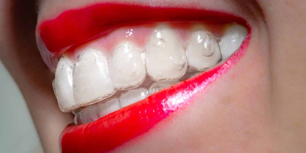 https://www.haltonvillagedental.ca/wp-content/uploads/2022/04/Say-Cheese-How-to-Get-the-Perfect-Heathy-Smile-1280x640.jpg