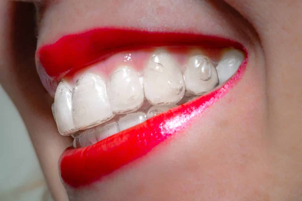 https://www.haltonvillagedental.ca/wp-content/uploads/2022/04/Say-Cheese-How-to-Get-the-Perfect-Heathy-Smile-1280x853.jpg