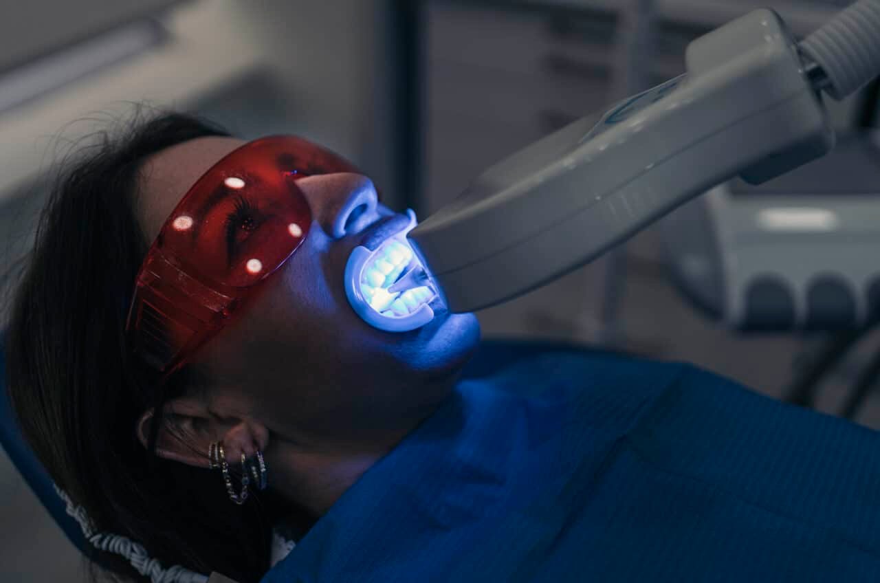 How long does whitening teeth last?