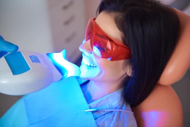 Professional Teeth Whitening Works