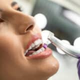 Can I eat after a dental cleaning?