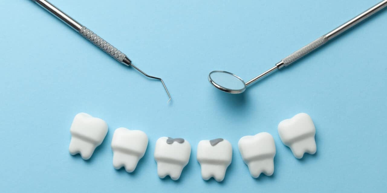 Do’s and Don’ts After Dental Filling