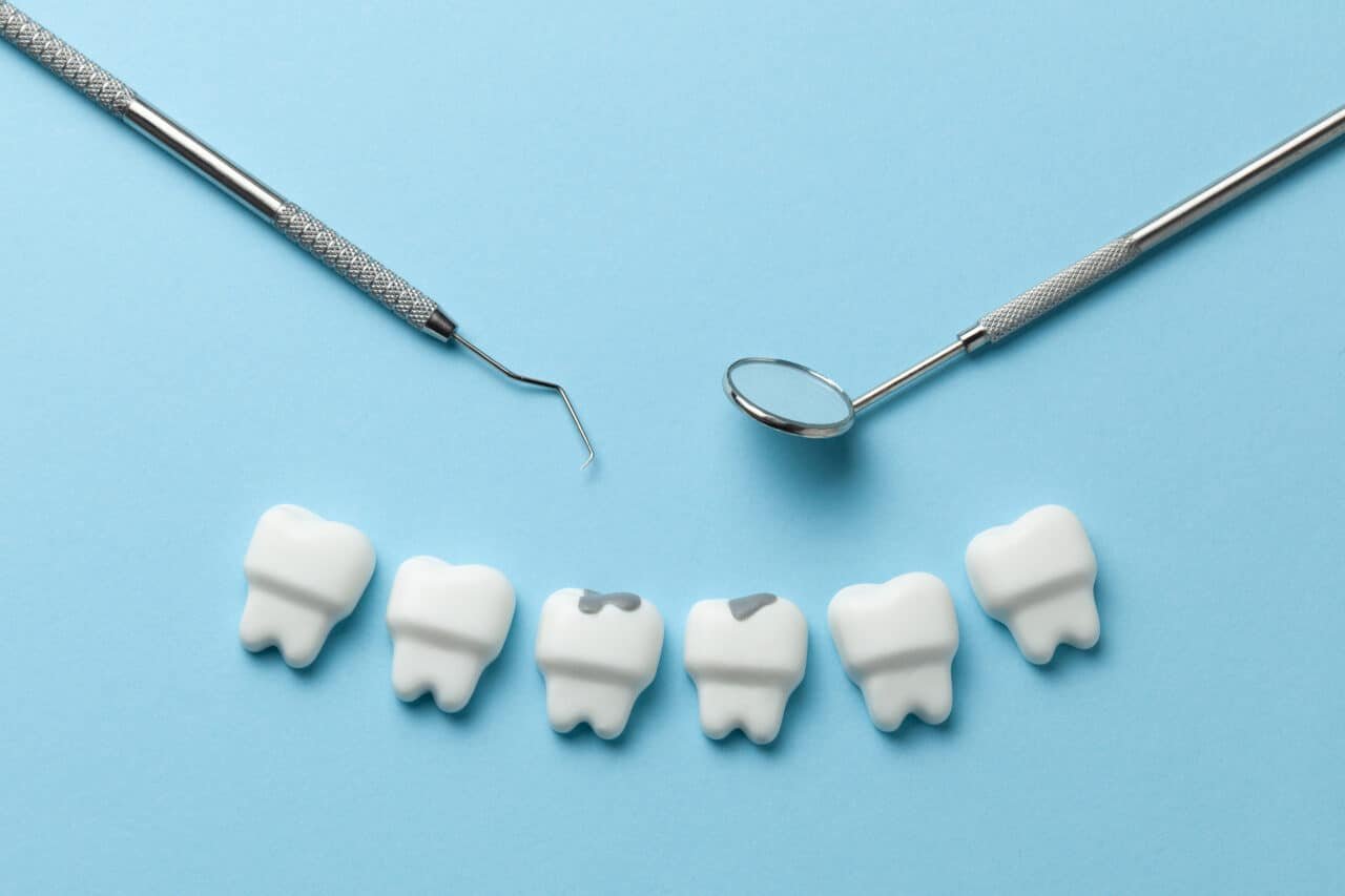 dental filling georgetown