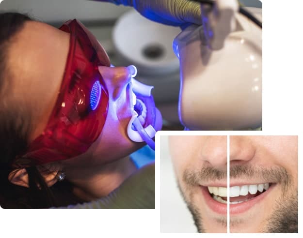 Teeth Whitening Georgetown, ON